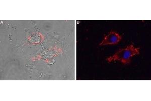 Expression of CaVγ5 (CACNG5) in living rat PC12 cells - Cell surface detection of CaVγ5 (CACNG5) in intact living rat PC12 cells using Anti-CACNG5 (extracellular) Antibody (ABIN7042993, ABIN7044061 and ABIN7044062), (1:25) followed by goat anti-rabbit-AlexaFluor-594 secondary antibody. (CACNG5 Antikörper  (1st Extracellular Loop))