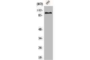 Western Blot analysis of 293 cells using ERCC4 Polyclonal Antibody (ERCC4 Antikörper  (C-Term))