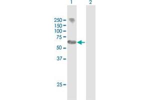 Western Blot analysis of MYCN expression in transfected 293T cell line by MYCN MaxPab polyclonal antibody. (MYCN Antikörper  (AA 1-464))