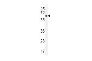 Western Blotting (WB) image for anti-V-Akt Murine Thymoma Viral Oncogene Homolog 1 (AKT1) (AA 428-457), (C-Term) antibody (ABIN655915)