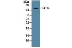 Western blot analysis of Human Serum. (ODC1 Antikörper  (AA 15-259))