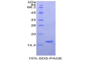 SDS-PAGE (SDS) image for Retinol Binding Protein 3, Interstitial (RBP3) (AA 1027-1229) protein (His tag) (ABIN2126672)