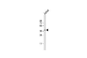 Anti-LEF1 Antibody (N-term) at 1:2000 dilution + Jurkat whole cell lysate Lysates/proteins at 20 μg per lane. (LEF1 Antikörper  (N-Term))