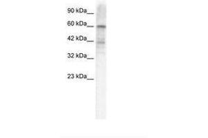 Image no. 1 for anti-Potassium Voltage-Gated Channel, Shal-Related Subfamily, Member 3 (KCND3) (AA 424-473) antibody (ABIN202843)