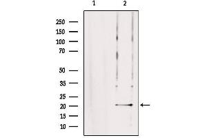 Western blot analysis of extracts from rat brain, using TRAPPC5 Antibody. (TRAPPC5 Antikörper  (Internal Region))