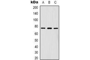 Western blot analysis of FOXK1 expression in Hela (A), A431 (B), Jurkat (C) whole cell lysates. (Foxk1 Antikörper  (C-Term))