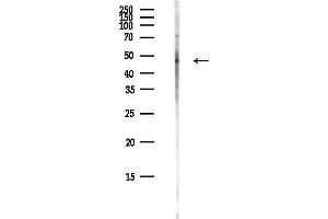 anti-DENN Domain Containing 11 (DENND11) antibody