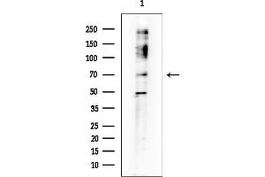 anti-Zinc Finger Protein 274 (ZNF274) antibody