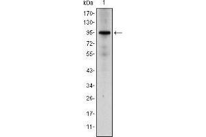 Glucocorticoid Receptor Antikörper