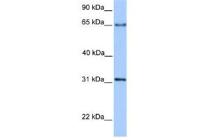 WB Suggested Anti-ZNF394 Antibody Titration:  0.