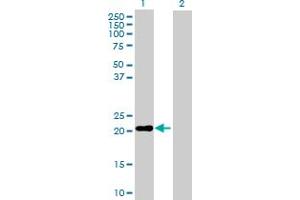 Western Blot analysis of MS4A4A expression in transfected 293T cell line by MS4A4A MaxPab polyclonal antibody. (MS4A4A Antikörper  (AA 1-220))