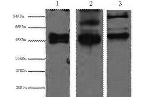 Western Blot analysis of 1) Hela, 2) MCF7, 3) 293T cells using CK-17 Monoclonal Antibody at dilution of 1:2000. (KRT17 Antikörper)