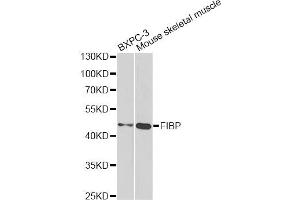 Western blot analysis of extracts of various cell lines, using FIBP antibody. (FIBP Antikörper)