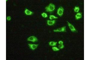 Figure:FITC staining on IHC-P Simple: Hela cells