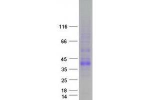 Western Blotting (WB) image for Tumor Necrosis Factor (Ligand) Superfamily, Member 11 (TNFSF11) (Transcript Variant 1) protein (Myc-DYKDDDDK Tag) (ABIN2713547)
