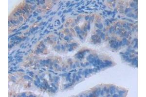 Immunohistochemistry (IHC) image for anti-Myosin Light Chain Kinase 2 (MYLK2) (AA 330-548) antibody (ABIN7443779)