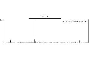 ChIP DNA-Sequencing (ChIP-seq) image for anti-Hypoxia Inducible Factor 1, alpha Subunit (Basic Helix-Loop-Helix Transcription Factor) (HIF1A) (AA 433-826) antibody (ABIN7453994)