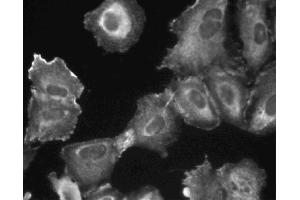 Immunofluorescent staining of A549 (ATCC CCL-185) cells. (PIK3C2B Antikörper  (AA 16-209))