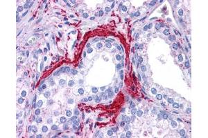 ATG5 antibody was used for immunohistochemistry at a concentration of 4-8 ug/ml. (ATG5 Antikörper)