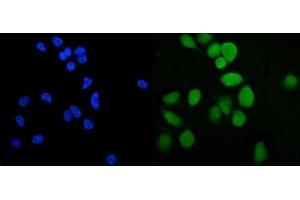IF analysis of PLTP using anti-PLTP antibody (ABIN7600346). (PLTP Antikörper  (AA 18-470))