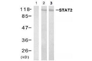 Western blot analysis of extracts from Hela cell and HL60 cell using stat2 (Ab-690) Antibody (E021536, Lane 1, 2 and 3 ) (STAT2 Antikörper)
