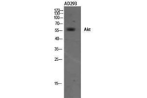 Western Blotting (WB) image for anti-V-Akt Murine Thymoma Viral Oncogene Homolog 1 (AKT1) (Internal Region) antibody (ABIN6282541)