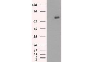 HEK293T cells were transfected with the pCMV6-ENTRY control (Left lane) or pCMV6-ENTRY BTK (Right lane) cDNA for 48 hrs and lysed. (BTK Antikörper)