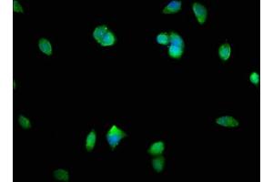 Immunofluorescence staining of MCF-7 cells with ABIN7160220 at 1:400, counter-stained with DAPI. (SMAD1 Antikörper  (AA 150-250))