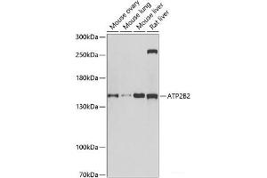 Western blot analysis of extracts of various cell lines using ATP2B2 Polyclonal Antibody at dilution of 1:1000. (ATP2B2 Antikörper)