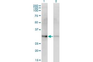 Western Blot analysis of CDK4 expression in transfected 293T cell line by CDK4 monoclonal antibody (M10), clone 1E1.