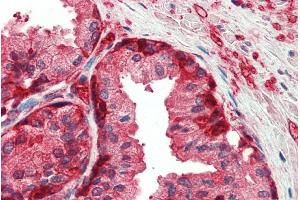 ABIN185418 (5µg/ml) staining of paraffin embedded Human Prostate. (GSTP1 Antikörper  (Internal Region))