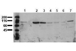 Western Blotting (WB) image for anti-Catenin (Cadherin-Associated Protein), beta 1, 88kDa (CTNNB1) (AA 35-50) antibody (ABIN126744) (CTNNB1 Antikörper  (AA 35-50))