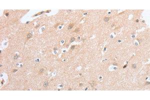Immunohistochemistry of paraffin-embedded Human brain tissue using SIGLEC9 Polyclonal Antibody at dilution 1:40 (SIGLEC9 Antikörper)