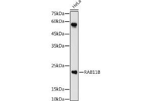 Western blot analysis of extracts of HeLa cells, using RB antibody (ABIN7269795) at 1:1000 dilution. (RAB11B Antikörper  (AA 130-215))