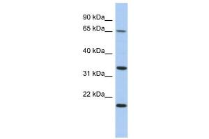 FAM79B antibody used at 1 ug/ml to detect target protein.