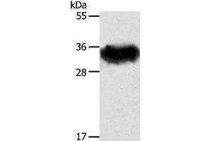 Western Blot analysis of Mouse brain tissue using STX1A Polyclonal Antibody at dilution of 1:600 (STX1A Antikörper)