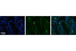 Rabbit Anti-SLCO2B1 Antibody     Formalin Fixed Paraffin Embedded Tissue: Human Lung Tissue  Observed Staining: Membrane in alveolar type I cells  Primary Antibody Concentration: 1:100  Other Working Concentrations: 1/600  Secondary Antibody: Donkey anti-Rabbit-Cy3  Secondary Antibody Concentration: 1:200  Magnification: 20X  Exposure Time: 0. (SLCO2B1 Antikörper  (N-Term))