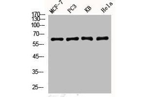 Western Blot analysis of MCF7 PC-3 KB HELA cells using Phospho-YAP (S127) Polyclonal Antibody (YAP1 Antikörper  (pSer127))