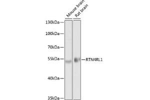 Western blot analysis of extracts of various cell lines, using RTN4RL1 antibody (ABIN6130678, ABIN6147298, ABIN6147299 and ABIN6214124) at 1:1000 dilution. (RTN4RL1 Antikörper  (AA 220-420))