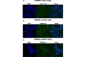 Immunofluorescent staining of HeLa (A), Huh7 (B) and MCF7 (C) cells with CENPN polyclonal antibody  at 1:250 dilution. (CENPN Antikörper  (Internal Region))