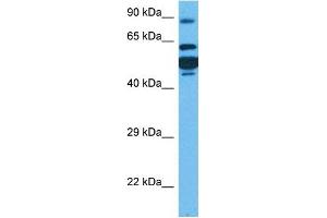 Host:  Rabbit  Target Name:  CPT1A  Sample Tissue:  Human HT1080 Whole Cell  Antibody Dilution:  1ug/ml (CPT1A Antikörper  (Middle Region))