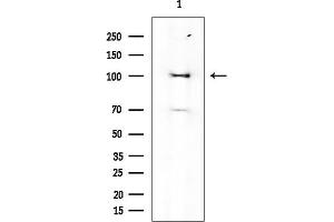 anti-MDM2 Binding Protein (MTBP) antibody