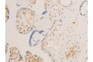 Immunohistochemistry (IHC) image for anti-Spleen tyrosine Kinase (SYK) (pTyr323) antibody (ABIN6256708)