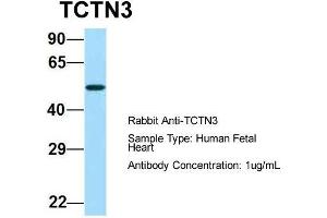 Host:  Rabbit  Target Name:  TCTN3  Sample Type:  Human Fetal Heart  Antibody Dilution:  1.