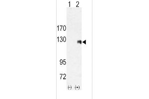 Western Blotting (WB) image for anti-Receptor Tyrosine Kinase-Like Orphan Receptor 2 (ROR2) (AA 915-943), (C-Term) antibody (ABIN392045)