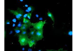 Anti-DOK7 mouse monoclonal antibody (ABIN2455816) immunofluorescent staining of COS7 cells transiently transfected by pCMV6-ENTRY DOK7 (RC219267). (DOK7 Antikörper)