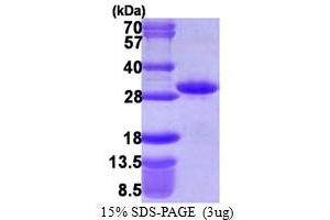 SDS-PAGE (SDS) image for rho Family GTPase 1 (RND1) (AA 1-200) protein (His tag) (ABIN667508)