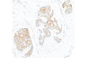 Immunohistochemistry (IHC) image for anti-Oxidized Low Density Lipoprotein (Lectin-Like) Receptor 1 (OLR1) (AA 61-273) antibody (ABIN7795657) (Rekombinanter OLR1 Antikörper  (AA 61-273))