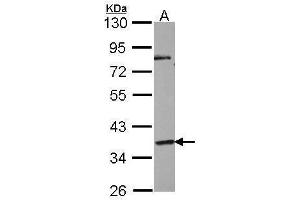 WB Image Sample (30 ug of whole cell lysate) A: NT2D1 10% SDS PAGE antibody diluted at 1:1000 (GPR45 Antikörper)