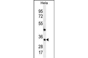 Western blot analysis in Hela cell line lysates (35ug/lane). (MED7 Antikörper  (AA 83-111))